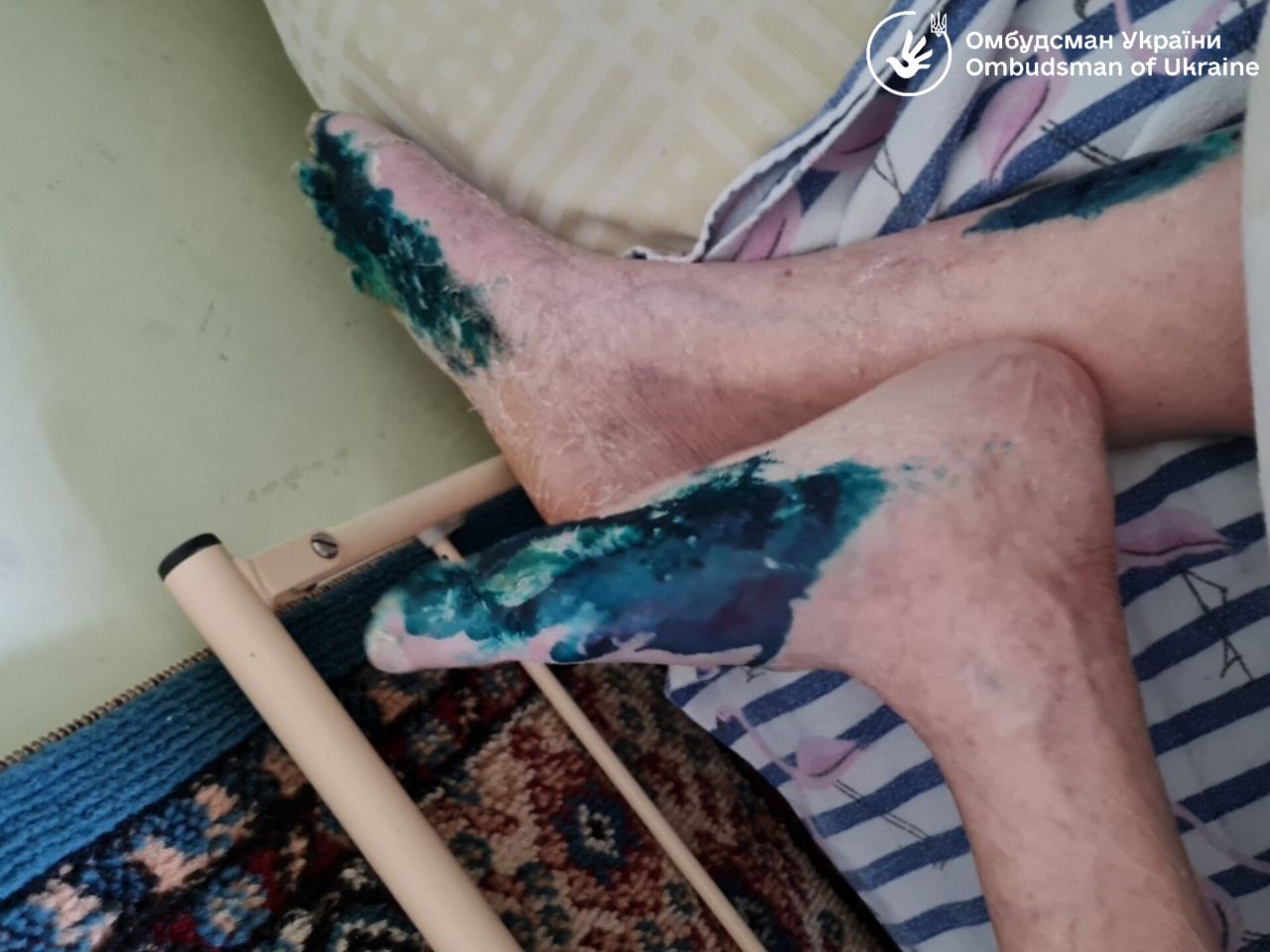 Без доступу до питної води і власних грошей: геріатричний пансіонат у Львові потрапив у скандал